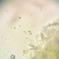 Bacillus Subtilis